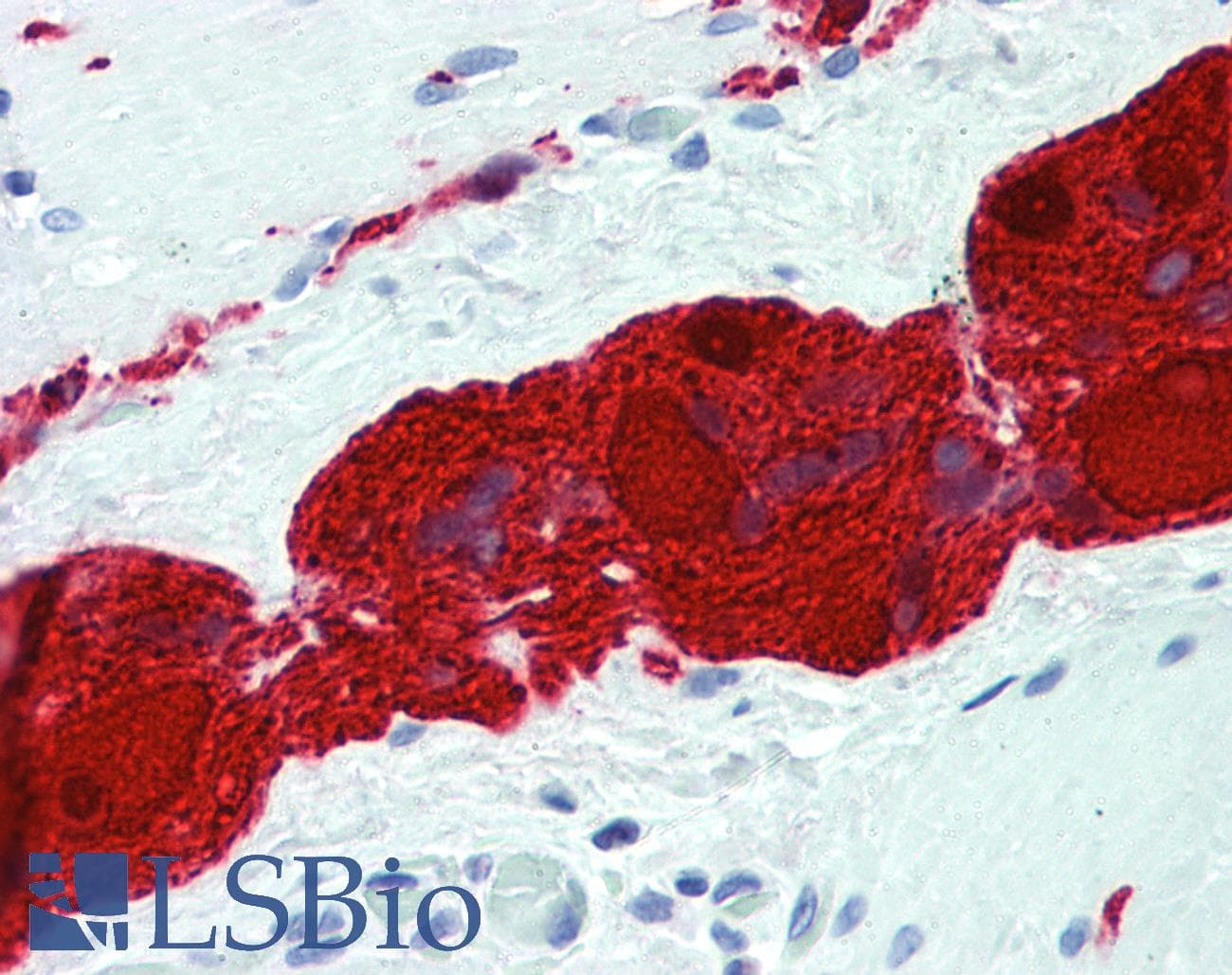PathPlus™ UCHL1 / PGP9.5 Antibody (clone 1B8-4D2)