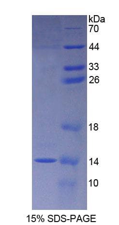 Rat S100A8 / MRP8 Protein (Recombinant His-T7)