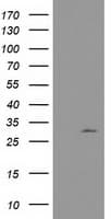 Monoclonal Mouse anti-Human NUBPL Antibody (clone OTI3D11, aa1-250, IHC, WB)