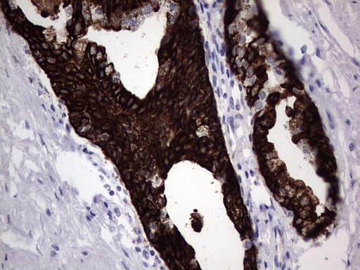 KRT19 / CK19 / Cytokeratin 19 Antibody (aa240-390, clone OTI3D10)
