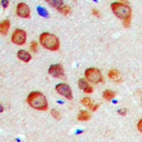 Polyclonal Rabbit anti-Human CABP7 Antibody (N-Terminus, IHC, WB)