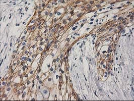 CTNNB1 / Beta Catenin Antibody (clone OTI12H7)