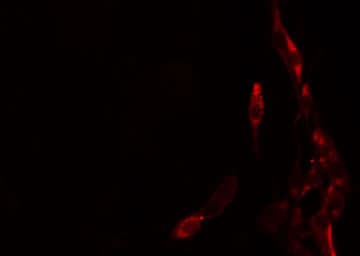HOXB9 Antibody