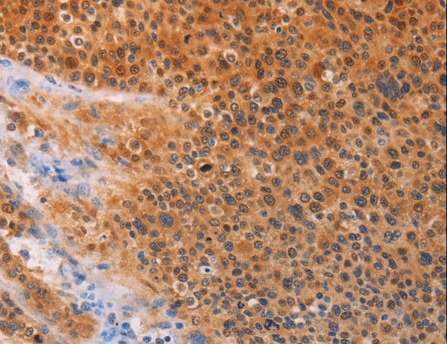 ADHFE1 Antibody