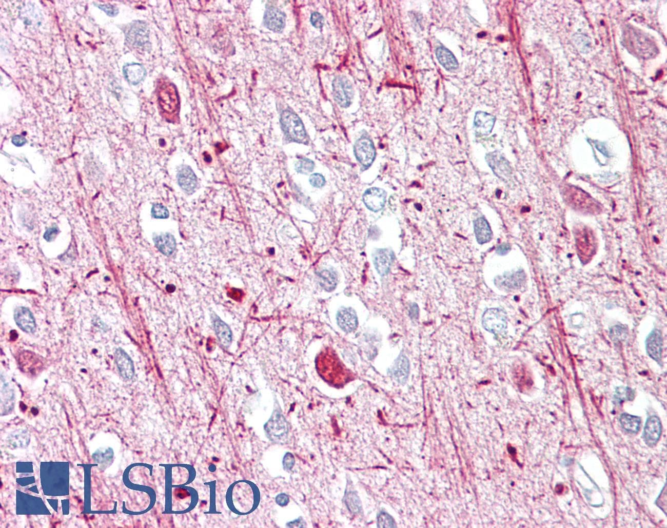 IHC-plus™ AR / Androgen Receptor Antibody (aa621-670)