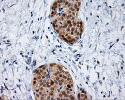 IFT57 / HIPPI Antibody (clone OTI2G3)
