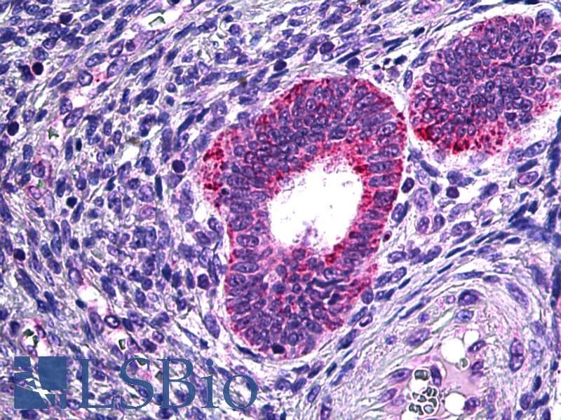 IHC-plus™ Polyclonal Goat anti-Human PLA2G4A Antibody (aa153-166, IHC, IF, WB)