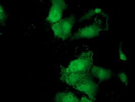 MOBKL2B / MOB3B Antibody (clone OTI1D12)