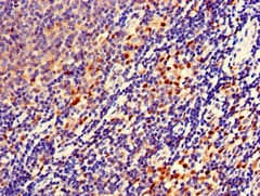 URP2 / FERMT3 Antibody
