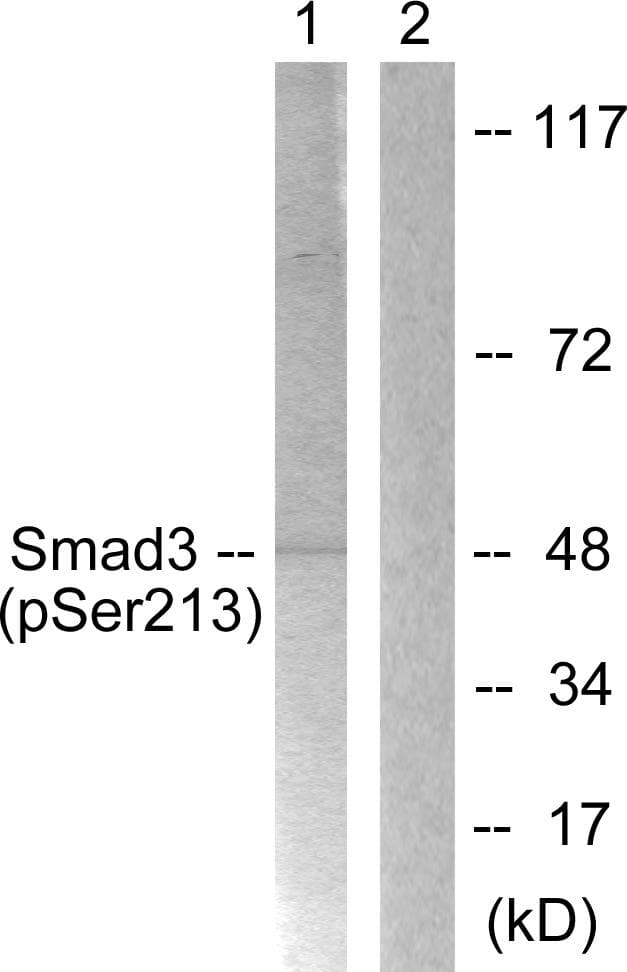 SMAD3 Antibody (phospho-Ser213)