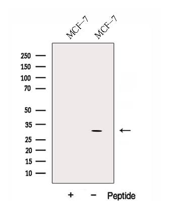 DIO2 Antibody
