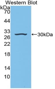 IGFBP4 Antibody (aa22-254)