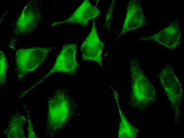 FAU / Fub1 Antibody (clone 3C10)