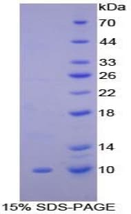 Rat SCGB1A1 / Uteroglobin Protein (Recombinant His)