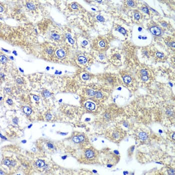 Polyclonal Rabbit anti-Human GLNRS / QARS Antibody (IHC, IF, WB)