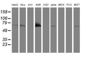 Monoclonal Mouse anti-Human BIRC3 / cIAP2 Antibody (clone OTI3G4, aa255-529, WB)