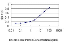Monoclonal Mouse anti-Human SCGB1A1 / Uteroglobin Antibody (clone 4A5-A11)