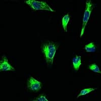 PathPlus™ Vimentin Antibody