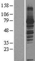 RASGRP3 / GRP3 Protein (Over-Expression Lysate Myc-DDK (Flag))