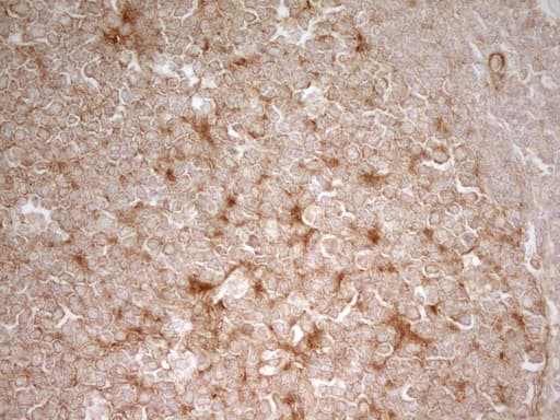 Monoclonal Mouse anti-Human PAK4 Antibody (clone OTI1C7, aa1-308, IHC, WB)