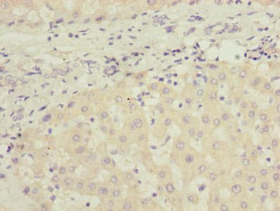 Polyclonal Rabbit anti-Human JADE1 / PHF17 Antibody (IHC)