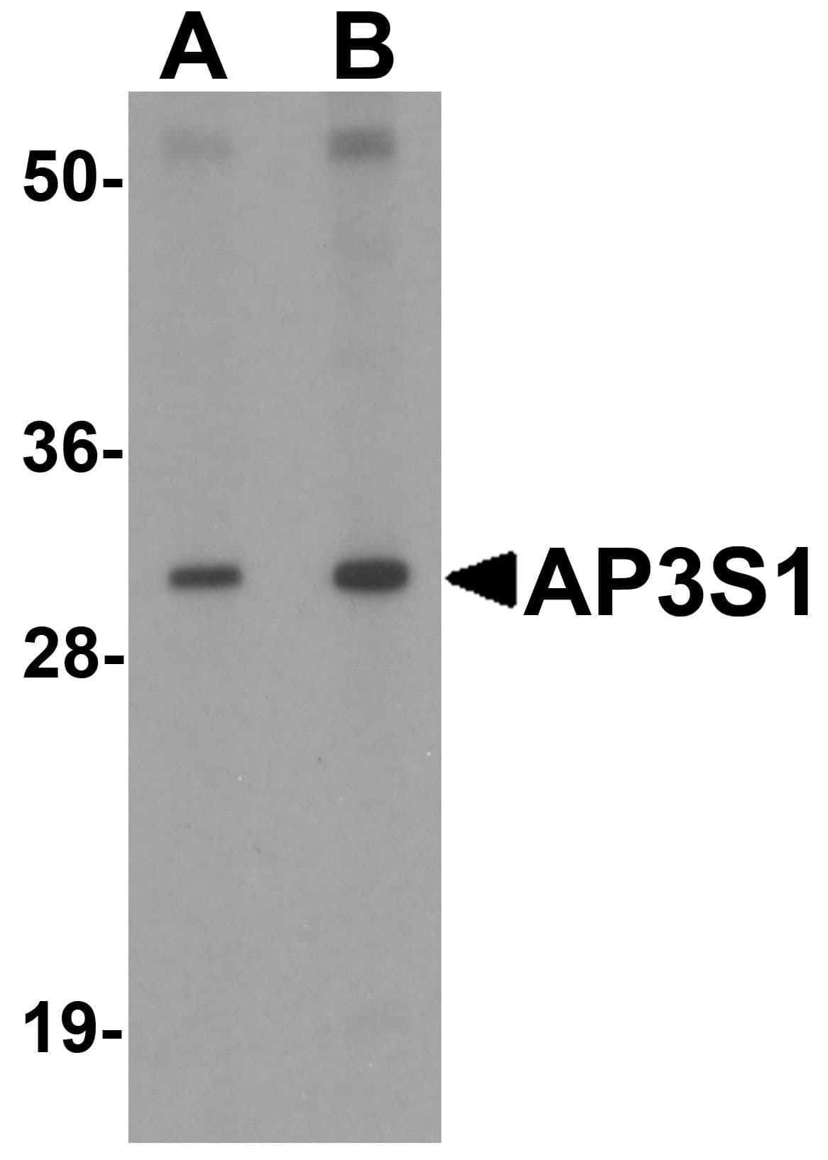 Polyclonal Rabbit anti-Human AP3S1 Antibody (IHC, IF, WB)