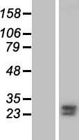 FKBP7 Protein (Over-Expression Lysate Myc-DDK (Flag))