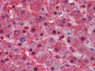 LPA / Lipoprotein a Antibody (clone 8F6A9,8H5C5)