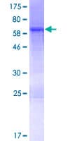 Human NUDEL / NDEL1 Protein (Recombinant GST)