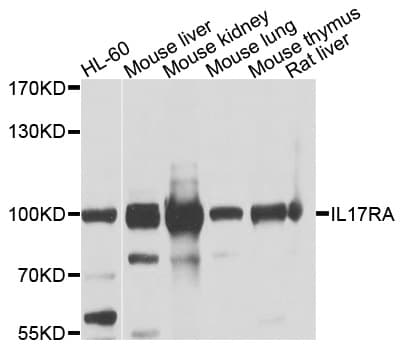 IHC-plus™ IL17RA Antibody