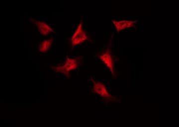 Polyclonal Rabbit anti-Human CTNNB1 / Beta Catenin Antibody (IHC, IF, WB)