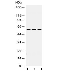 Polyclonal Rabbit anti-Human ALDH7A1 Antibody (IHC, WB)