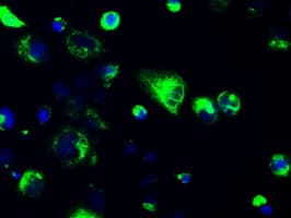 GFAP Antibody (clone OTI2F7)