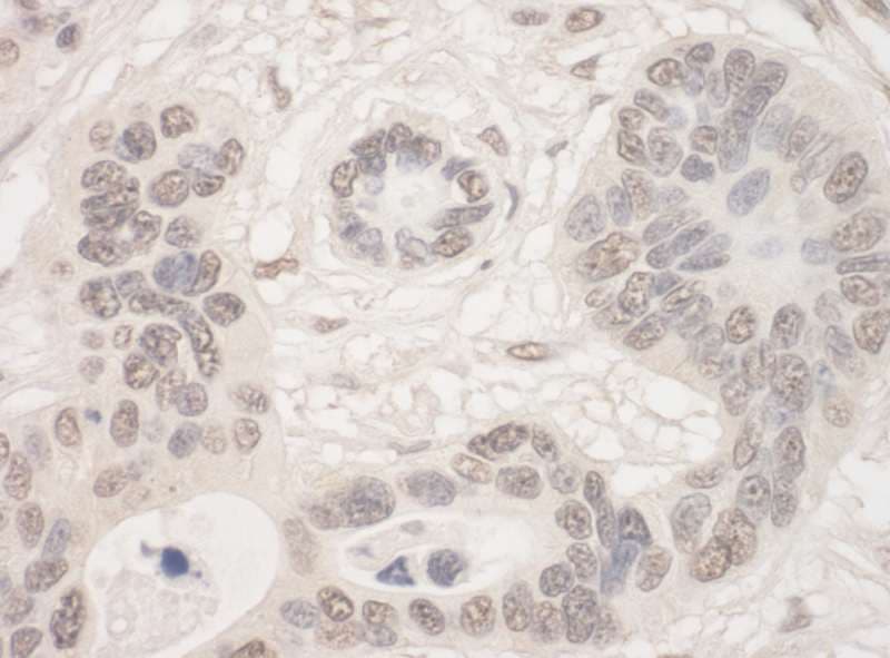 THOC2 Antibody (aa1543-1593)