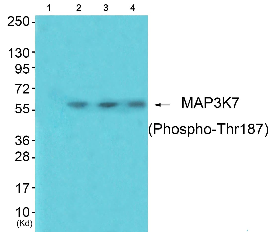 MAP3K7 / TAK1 Antibody (phospho-Thr187)