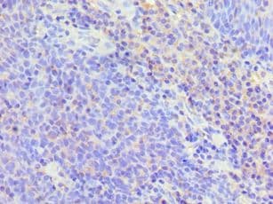 BAFF / TNFSF13B Antibody (aa76-285)