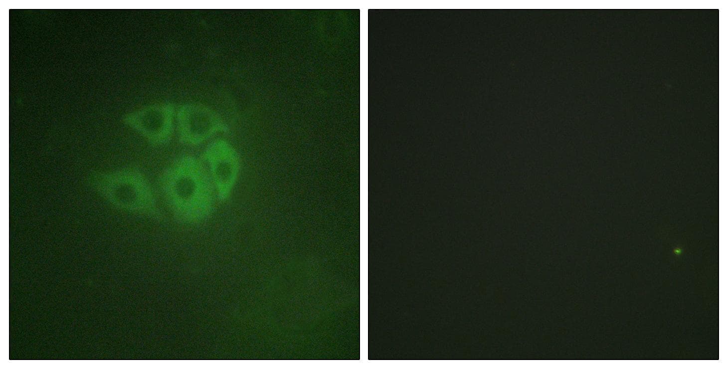 PLCB3 Antibody