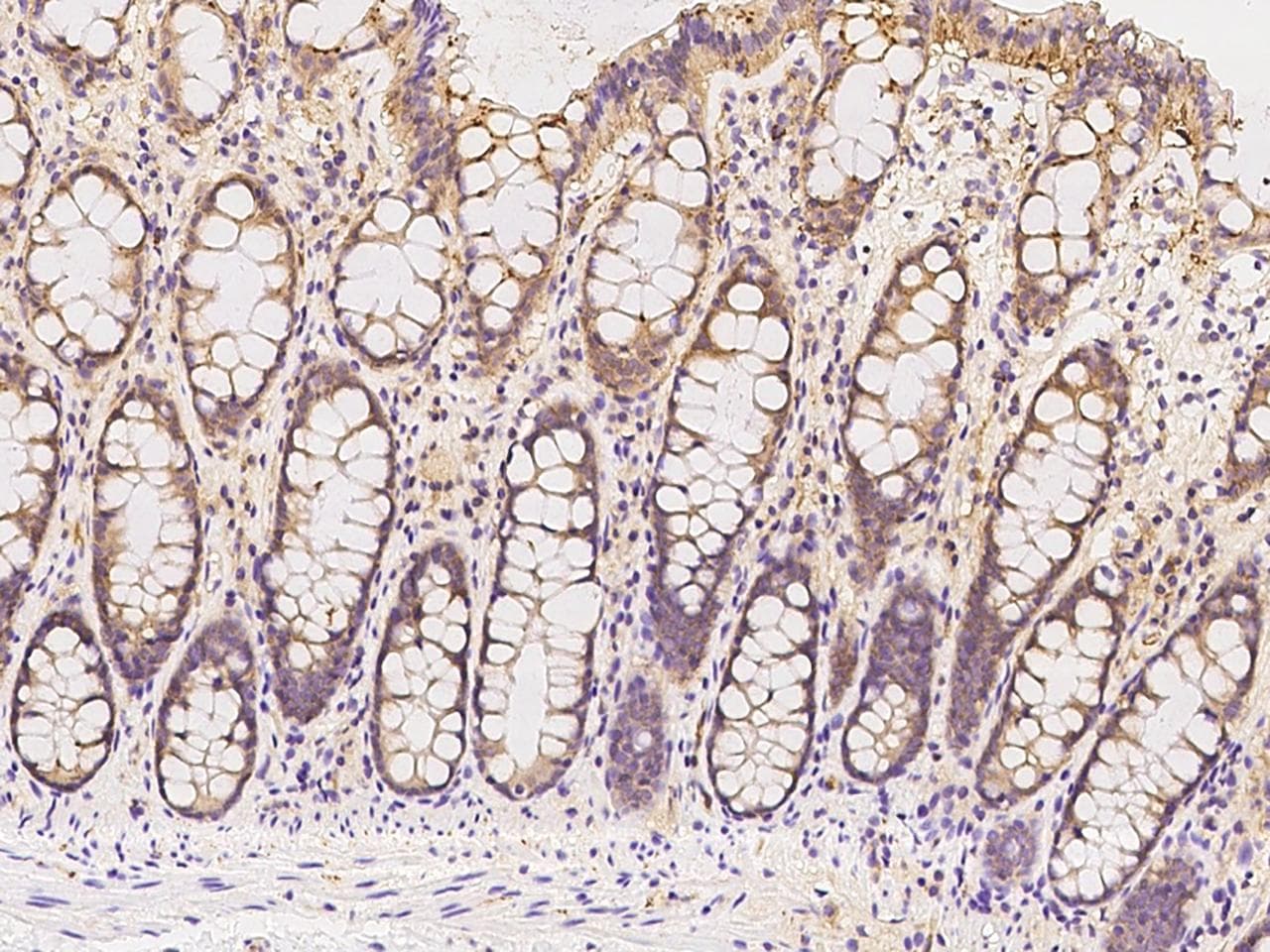 Polyclonal Rabbit anti-Human CDCP1 Antibody (IHC, WB)