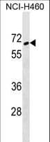 ZNF83 / HPF1 Antibody (aa1-30)