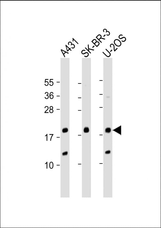 THRSP Antibody (aa18-48)