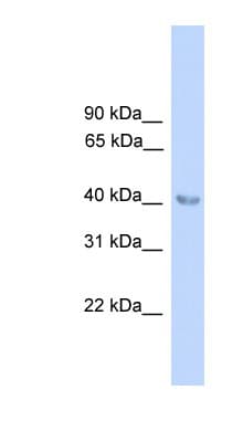 Polyclonal Rabbit anti-Human ALAD Antibody (N-Terminus, WB)