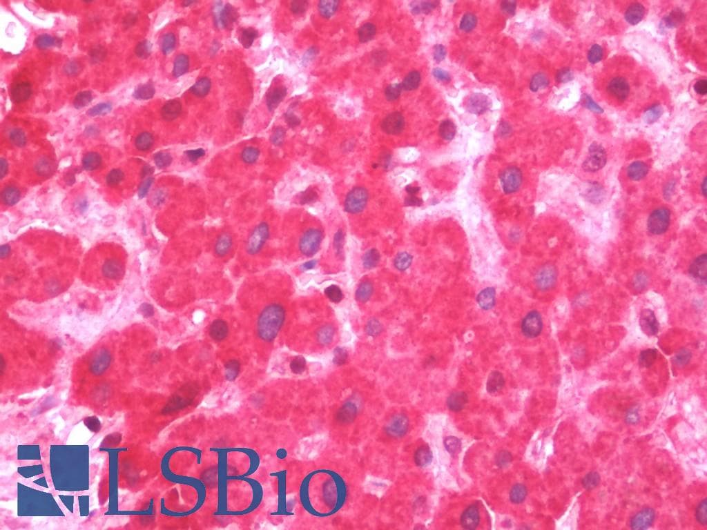 IHC-plus™ Polyclonal Rabbit anti-Human FSP27 / CIDEC Antibody (IHC, IF, WB)