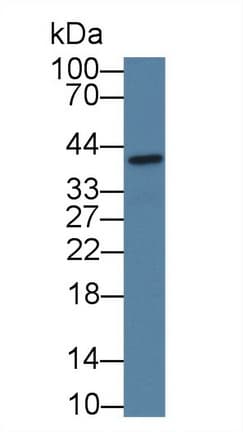CTRB2 / Chymotrypsinogen B2 Antibody (aa34-263, PE)