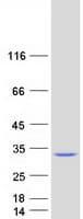 Human GSTA5 Protein (Recombinant Myc-DDK (Flag))
