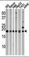 Polyclonal Rabbit anti-Human MAP1LC3C / LC3C Antibody (aa1-30, IHC, WB)