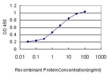 Monoclonal Mouse anti-Human FABP3 / H-FABP Antibody (clone 4F6-1D6, WB)