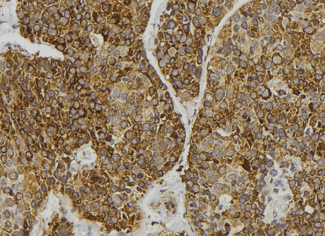 Polyclonal Rabbit anti-Human GIPC2 Antibody (IHC, WB)