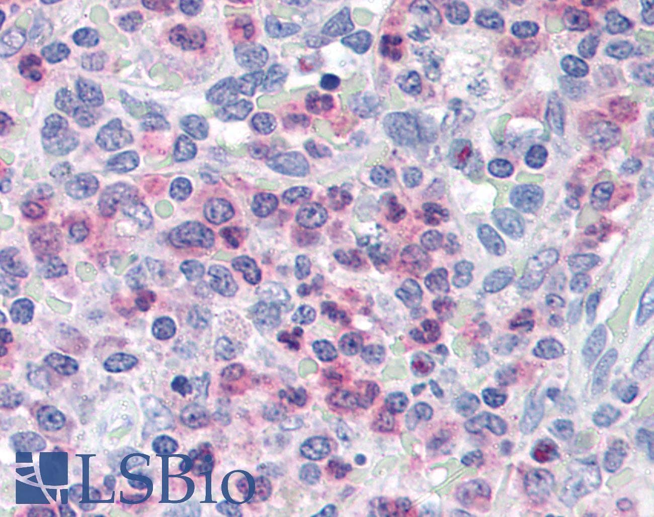 IHC-plus™ Polyclonal Goat anti-Human UNC13D Antibody (aa1079-1090, IHC, WB)