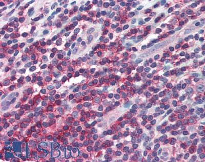 PathPlus™ IL10RA Antibody (clone 1D10)