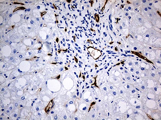 Monoclonal Mouse anti-Human CD34 Antibody (clone OTI8F11, aa312-385, IHC, WB)